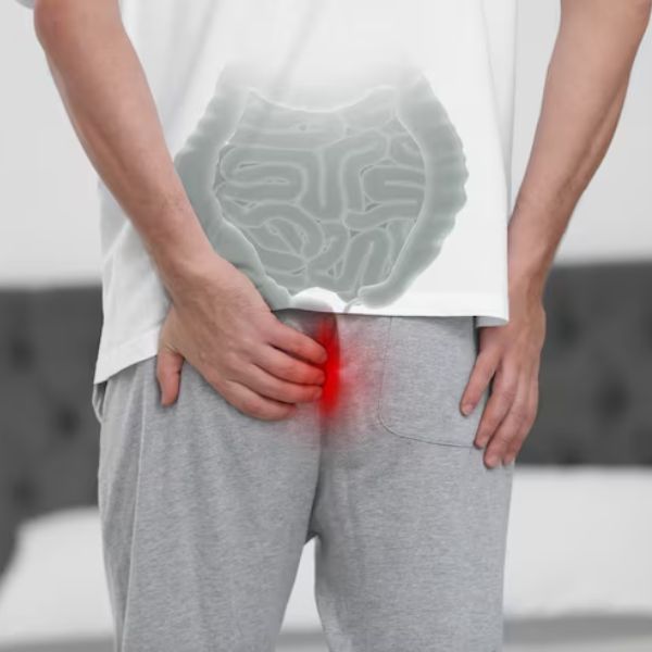 Piles, Fistula, Fissure Treatment<br />
